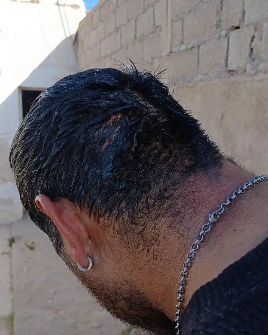 Mujer agrede con botella a su expareja tras irrumpir en su casa en Santa Celia